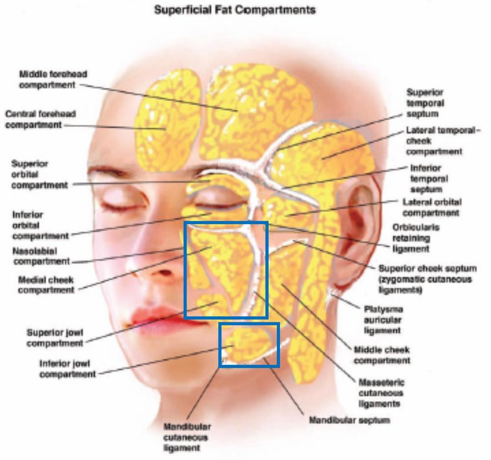 Diagram of Cheek Fat Pads