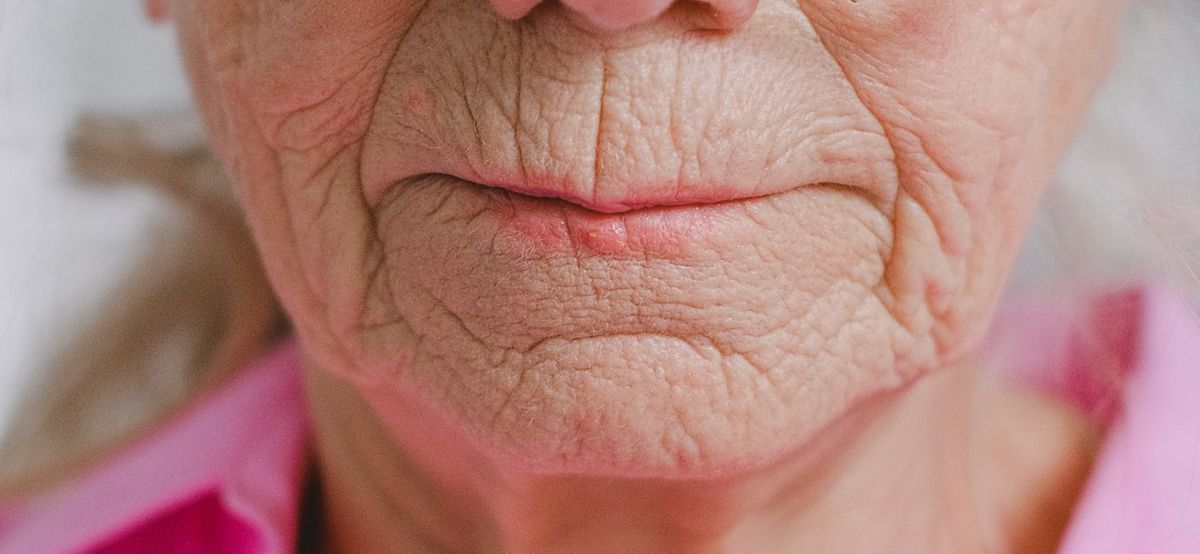 Facial plastic surgery in Cincinnati, Ohio