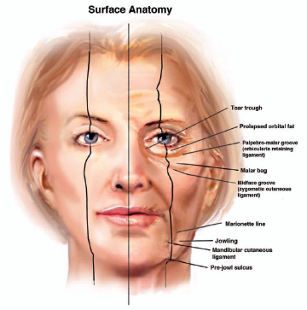 Diagram of Sequelae of Facial Aging