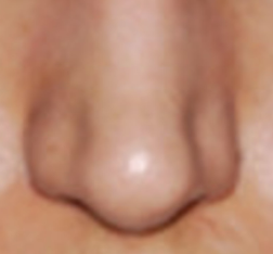Nose.png